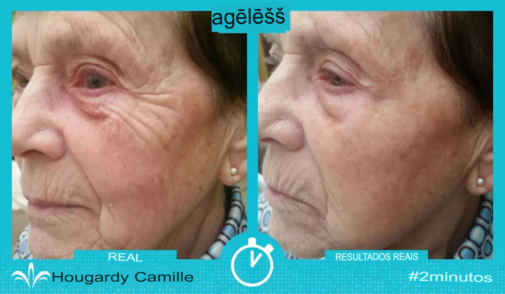 Ageless 50 unidades — Anti-Rugas com Efeito Lifting Instantâneo | Fabricado nos EUA 🇺🇸
