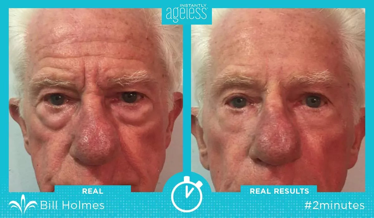 Ageless 50 unidades — Anti-Rugas com Efeito Lifting Instantâneo | Fabricado nos EUA 🇺🇸