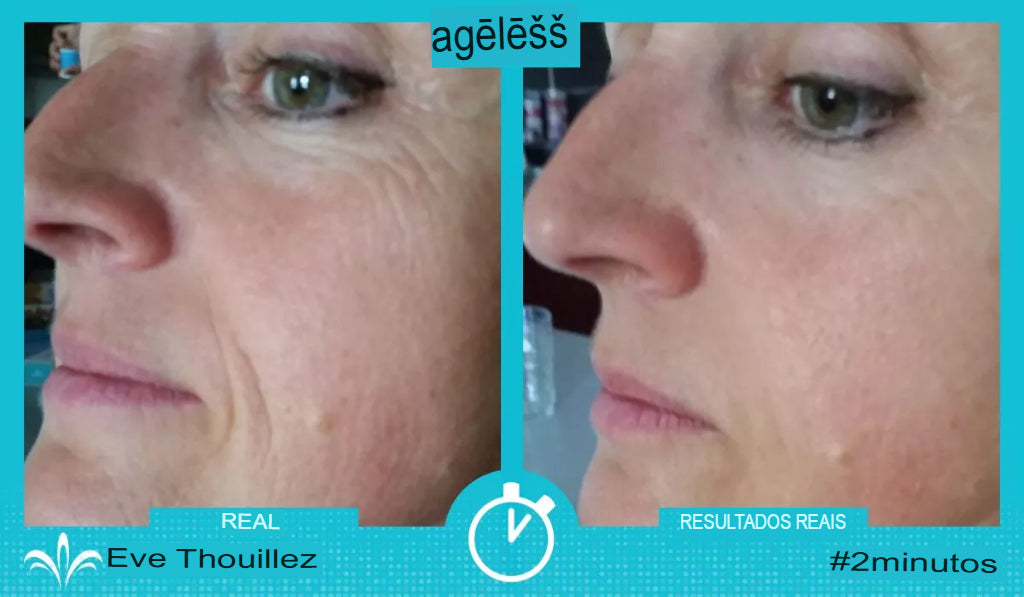Ageless 50 unidades — Anti-Rugas com Efeito Lifting Instantâneo | Fabricado nos EUA 🇺🇸