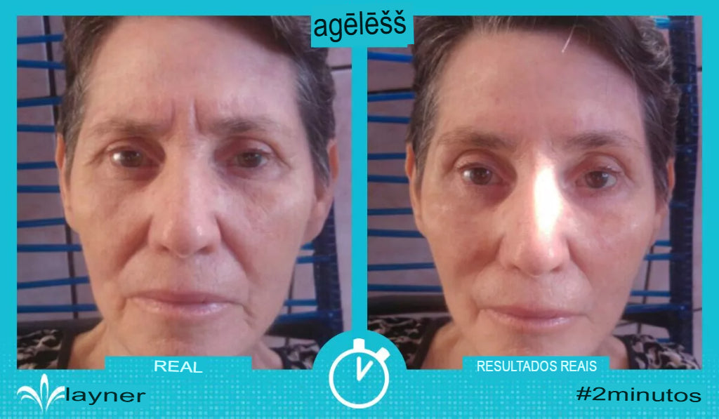Ageless 50 unidades — Anti-Rugas com Efeito Lifting Instantâneo | Fabricado nos EUA 🇺🇸